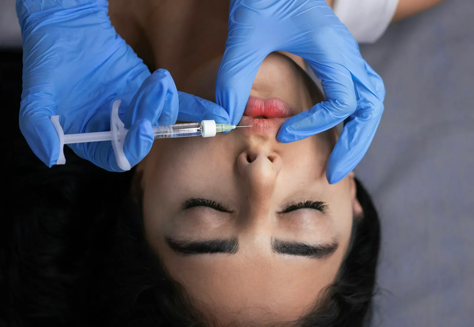 Medicina estética en Clínica Roma