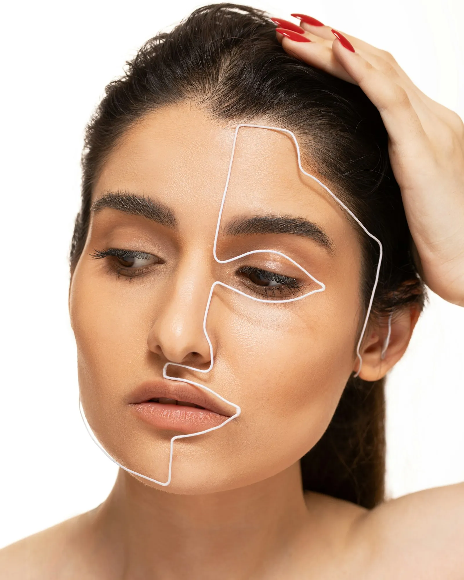 Marcaje facial pre-procedimiento del mini lifting con anestesia local