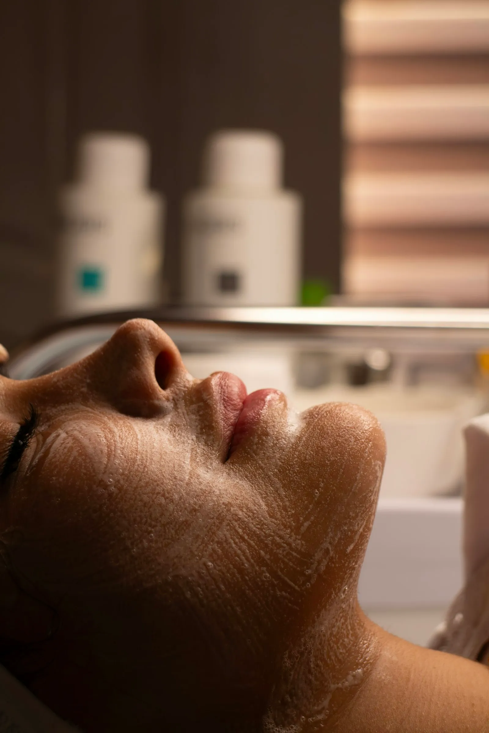 Limpieza facial profunda en Benalmádena · Clínica Roma