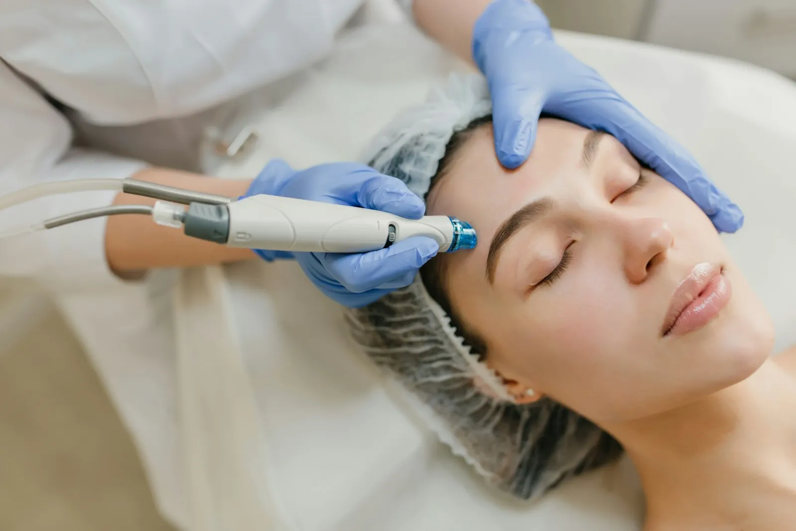 Peeling químico en Málaga · Clínica Roma
